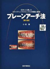 プレーンアーチ法 日本人に適したスライディングメカニクスの理論と臨床 第３版