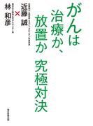 がんは治療か、放置か 究極対決(週刊エコノミストebooks)