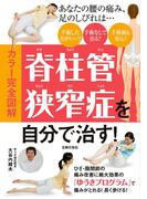 カラー完全図解　脊柱管狭窄症を自分で治す！