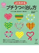 よくわかるプチうつの治し方(セレクトBOOKS)