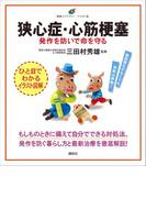 狭心症・心筋梗塞　発作を防いで命を守る(健康ライブラリーイラスト版)