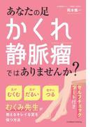 あなたの足、かくれ静脈瘤ではありませんか？