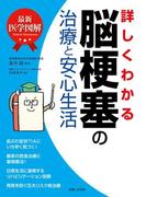 最新医学図解　詳しくわかる脳梗塞の治療と安心生活