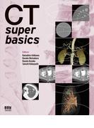 CT super basics