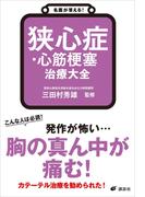 名医が答える！　狭心症・心筋梗塞　治療大全(健康ライブラリー)