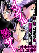 インフル怨サー。 ～顔を焼かれた私が復讐を誓った日～（分冊版） 【第47話】(comic RiSky(リスキー))