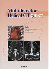 全身のＣＴ／高橋睦正【編著】-