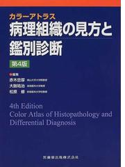 病理組織の見方と鑑別診断 第４版の通販/赤木 忠厚/大朏 祐治 - 紙の本