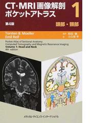 胸部のＣＴ 第４版の通販/村田 喜代史/上甲 剛 - 紙の本：honto