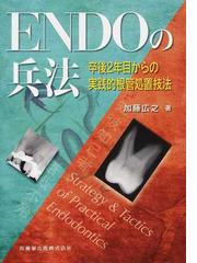 ＥＮＤＯの兵法 卒後２年目からの実践的根管処置技法の通販/加藤 広之