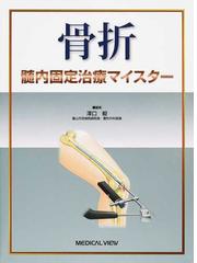 前大脳動脈瘤・椎骨脳底動脈瘤ＡＣＡ・ＶＢＡ Ａｎｅｕｒｙｓｍの