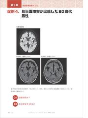 画像診断ドリル 救急医と放射線科医が伝授する適切なオーダーと読影法の通販 藪田 実 篠塚 健 紙の本 Honto本の通販ストア