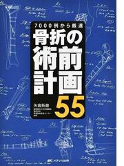 前大脳動脈瘤・椎骨脳底動脈瘤ＡＣＡ・ＶＢＡ Ａｎｅｕｒｙｓｍの