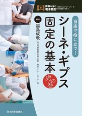 前大脳動脈瘤・椎骨脳底動脈瘤ＡＣＡ・ＶＢＡ Ａｎｅｕｒｙｓｍの