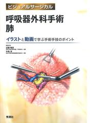 呼吸器外科手術 肺 イラストと動画で学ぶ手術手技のポイントの通販 近藤 晴彦 中島 淳 紙の本 Honto本の通販ストア