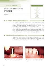 検証コーヌスクローネ 長期経過症例と臨床統計からの再評価の通販 