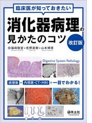 わかりやすい核医学 第２版の通販/玉木 長良/平田 健司 - 紙の本