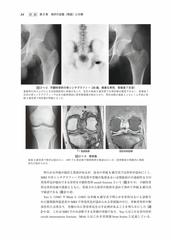 売れ筋がひ贈り物！ 骨折・脱臼 改訂５版/冨士川恭輔 臨床医学外科系