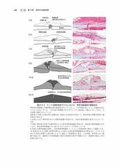 売れ筋がひ贈り物！ 骨折・脱臼 改訂５版/冨士川恭輔 臨床医学外科系