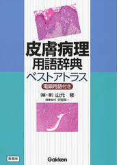 虫と皮膚炎 Ｄｒ．夏秋の臨床図鑑 改訂第２版の通販/夏秋 優 - 紙の本