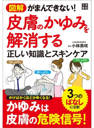 図解 がまんできない! 皮膚のかゆみを解消する正しい知識とスキンケア