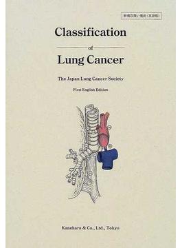 肺癌取扱い規約 Ｃｌａｓｓｉｆｉｃａｔｉｏｎ ｏｆ ｌｕｎｇ ｃａｎｃｅｒ 英語版