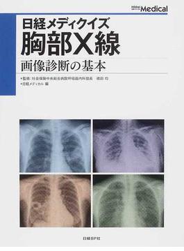 日経メディクイズ 胸部Ｘ線 画像診断の基本