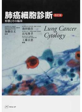 肺癌細胞診断 形態とその臨床 改訂版