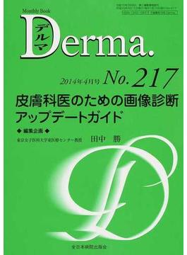 デルマ Ｎｏ．２１７（２０１４年４月号） 皮膚科医のための画像診断アップデートガイド