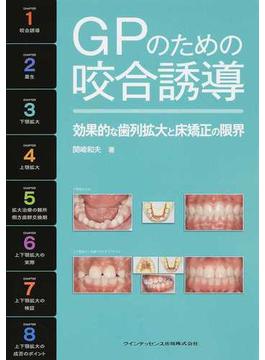 ＧＰのための咬合誘導 効果的な歯列拡大と床矯正の限界