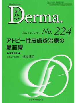 デルマ Ｎｏ．２２４（２０１４年１１月号） アトピー性皮膚炎治療の最前線