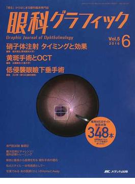 眼科グラフィック 「視る」からはじまる眼科臨床専門誌 第５巻６号（２０１６−６） 硝子体注射タイミングと効果ほか