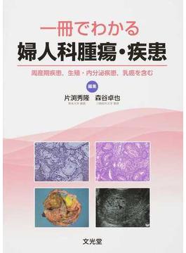 一冊でわかる婦人科腫瘍・疾患 周産期疾患，生殖・内分泌疾患，乳癌を含む