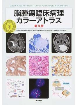脳腫瘍臨床病理カラーアトラス 第４版