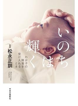 いのちは輝く　わが子の障害を受け入れるとき