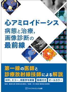 心アミロイドーシス　病態と治療，画像診断の最前線