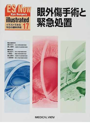 ｅｓ ｎｏｗ ｉｌｌｕｓｔｒａｔｅｄ イラストでみる今日の眼科手術 １７ 眼外傷手術と緊急処置の通販 樋田 哲夫 桑山 泰明 紙の本 Honto本の通販ストア
