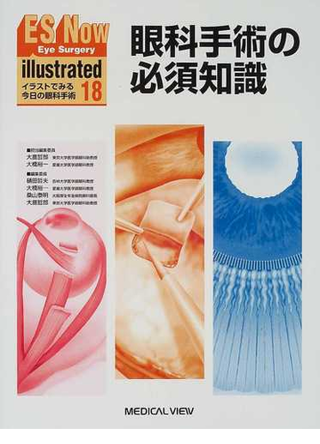 ｅｓ ｎｏｗ ｉｌｌｕｓｔｒａｔｅｄ イラストでみる今日の眼科手術 １８ 眼科手術の必須知識の通販 樋田 哲夫 大鹿 哲郎 紙の本 Honto本の通販ストア