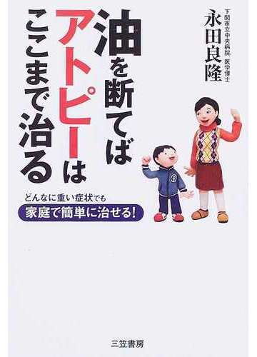 油を断てばアトピーはここまで治る どんなに重い症状でも家庭で簡単に治せる の通販 永田 良隆 紙の本 Honto本の通販ストア