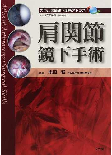 肩関節鏡下手術の通販 米田 稔 越智 光夫 紙の本 Honto本の通販ストア
