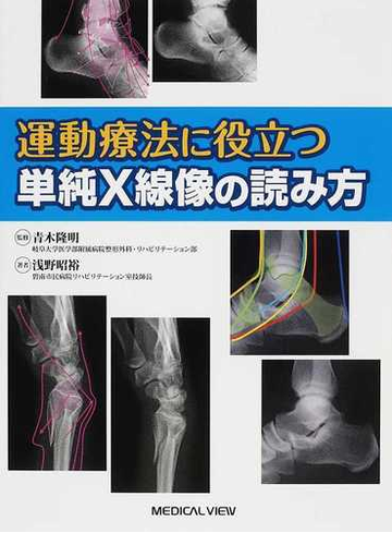 運動療法に役立つ単純ｘ線像の読み方の通販 浅野 昭裕 青木 隆明 紙の本 Honto本の通販ストア
