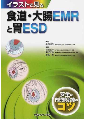 イラストで見る食道 大腸ｅｍｒと胃ｅｓｄ 安全な内視鏡治療のコツの通販 上西 紀夫 松橋 信行 紙の本 Honto本の通販ストア