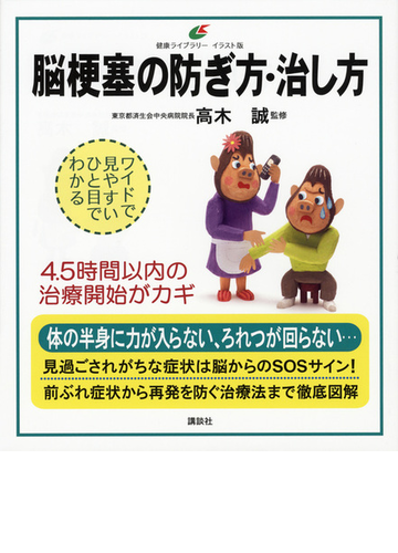 脳梗塞の防ぎ方 治し方 イラスト版の通販 高木 誠 健康ライブラリー 紙の本 Honto本の通販ストア