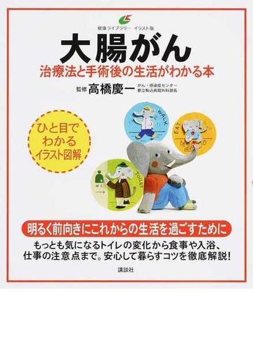 大腸がん 治療法と手術後の生活がわかる本 イラスト版の通販 高橋 慶一 健康ライブラリー 紙の本 Honto本の通販ストア