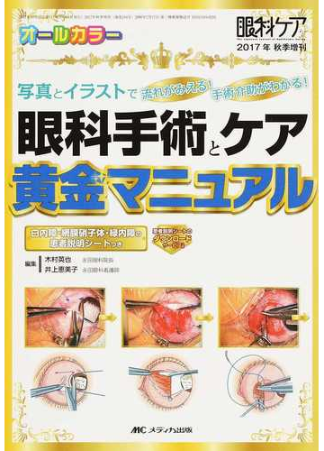 眼科手術とケア黄金マニュアル 写真とイラストで流れがみえる 手術介助がわかる 白内障 網膜硝子体 緑内障の患者説明シートつきの通販 木村 英也 井上 恵美子 紙の本 Honto本の通販ストア