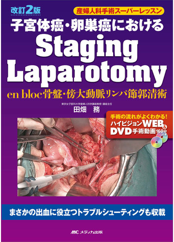 子宮体癌 卵巣癌におけるstaging laparotomy en bloc骨盤 傍大動脈リンパ節郭清術 改訂2版の通販 田畑 務 紙の本 Honto本の通販ストア