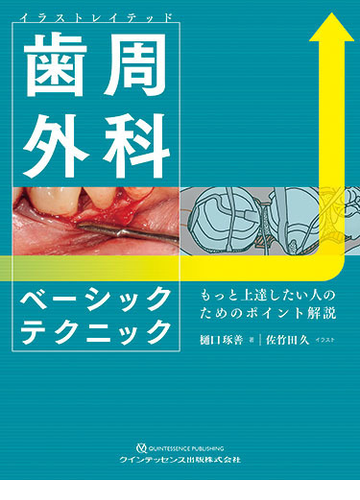 イラストレイテッド歯周外科ベーシックテクニック もっと上達したい人のためのポイント解説の通販 樋口 琢善 佐竹田 久 紙の本 Honto本の通販ストア