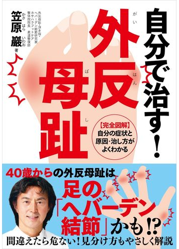 自分で治す 外反母趾 完全図解 自分の症状と原因 治し方がよくわかるの通販 笠原 巖 紙の本 Honto本の通販ストア