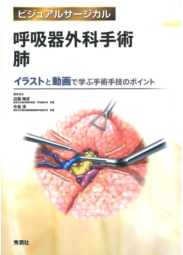 店舗良い 伊藤宏之 著 イラストで理解する呼吸器外科手術のエッセンス 本 雑誌 医学 薬学 Www Kbtools Com