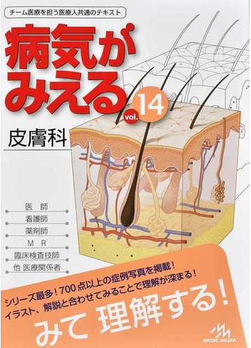 病気がみえる ｖｏｌ １４ 皮膚科の通販 医療情報科学研究所 紙の本 Honto本の通販ストア